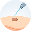 procedure picture