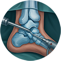 procedure picture