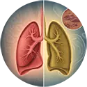 בירור ואבחון גידולי ריאות