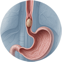 procedure picture