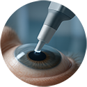 procedure picture