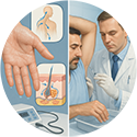 procedure picture
