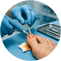 procedure picture