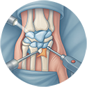 procedure picture